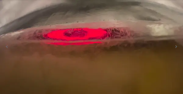 Live Vinegar Eels in Vinegar